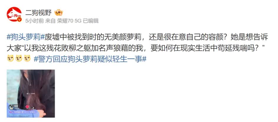 网红狗头萝莉退网 称要走出阴影重新开始生活